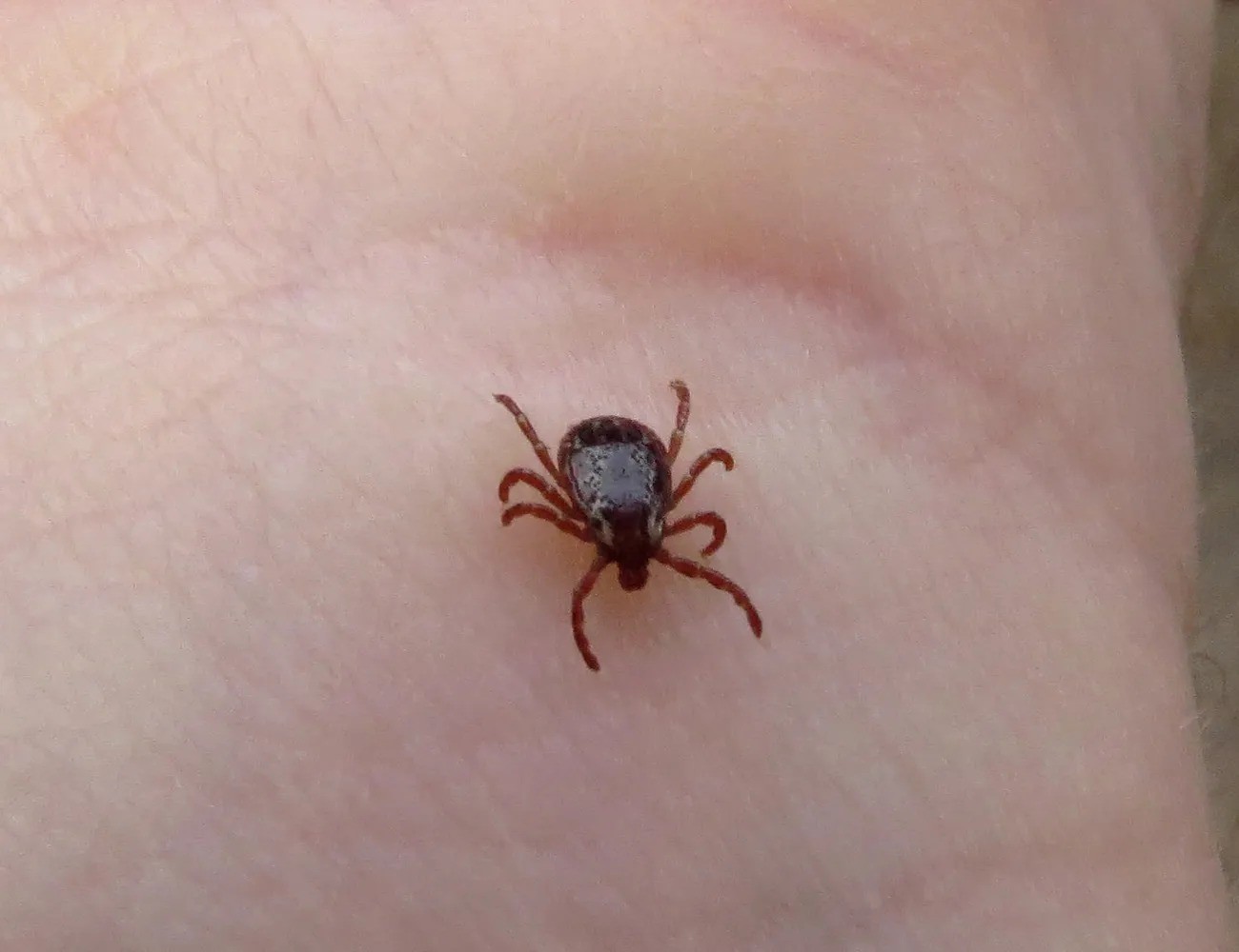 get rid of ticks in yard
